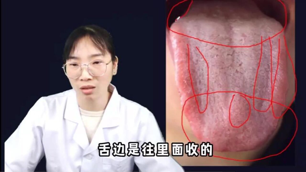 舌诊详细讲解肝郁_高清1080P在线观看平台_腾讯视频