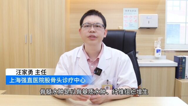 上海强直医院股骨头诊疗中心汪家勇主任谈:什么是骨髓水肿及股骨头坏死骨髓水肿?