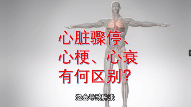 心脏骤停、心梗、心衰,都指什么?有什么区别?