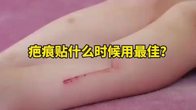 疤痕贴什么时候用最佳?