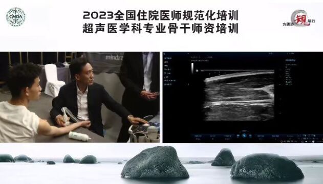 软组织超声检查的操作规范及要领指导演示