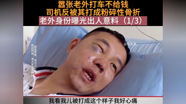 1737嚣张老外打车不给钱,司机反被其打成粉碎性骨折,老外身份曝光出人意料老外出租车纪录片