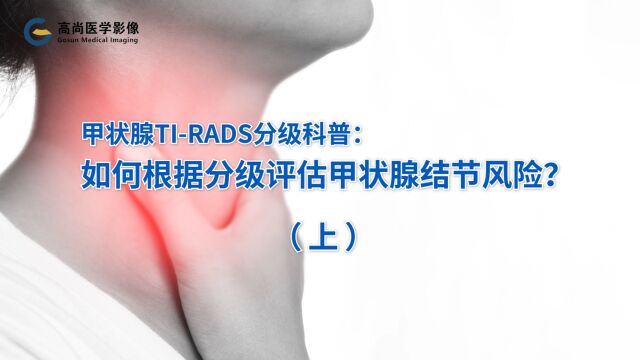 甲状腺TIRADS分级科普:如何根据分级评估甲状腺结节风险?(上)