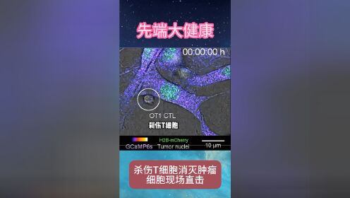 杀伤t细胞在线消灭肿瘤细胞,干细胞治疗抗癌