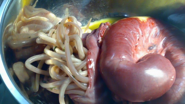 不论是大人还是孩子长时间的不吃驱虫药,肚子里都会有蛔虫的!_腾讯视