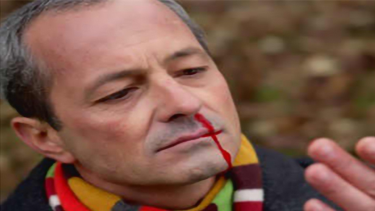 流鼻血偏方这么多,仰头举手揪耳朵?结果可能会更严重!