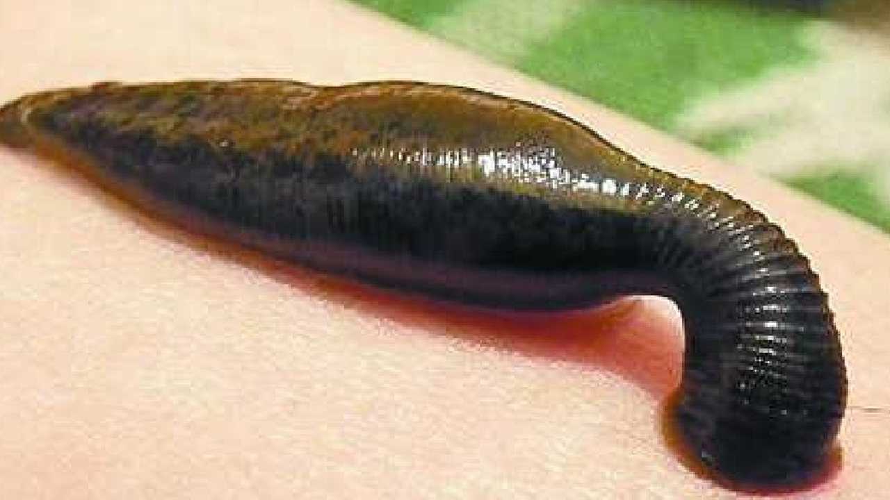 遇到水蛭吸血千万不要拽国外小哥实验教你如何对付蚂蟥