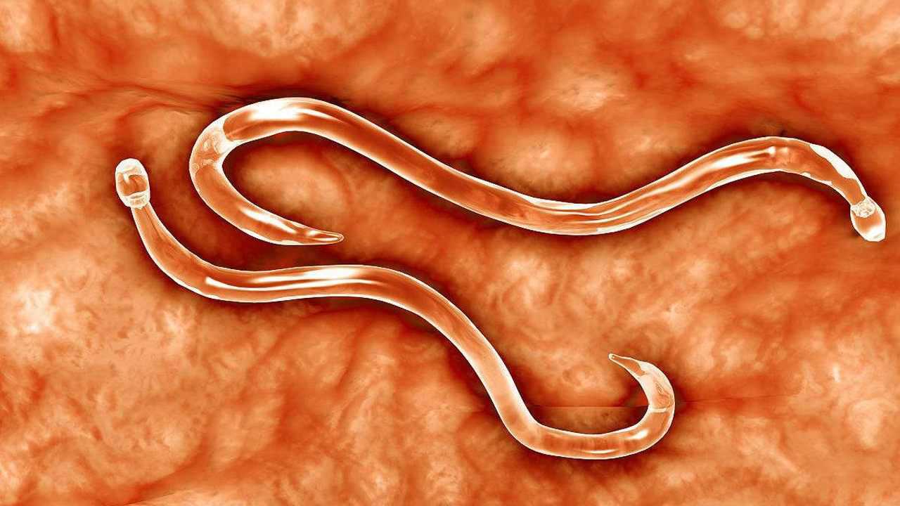 如何辨别肚子里有没有蛔虫?专家帮你支招_腾讯视频