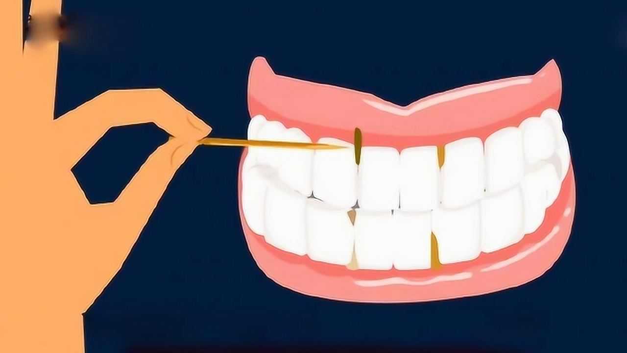 常用牙签剔牙可使牙缝变大,吃饭后塞牙了,应如何处理?