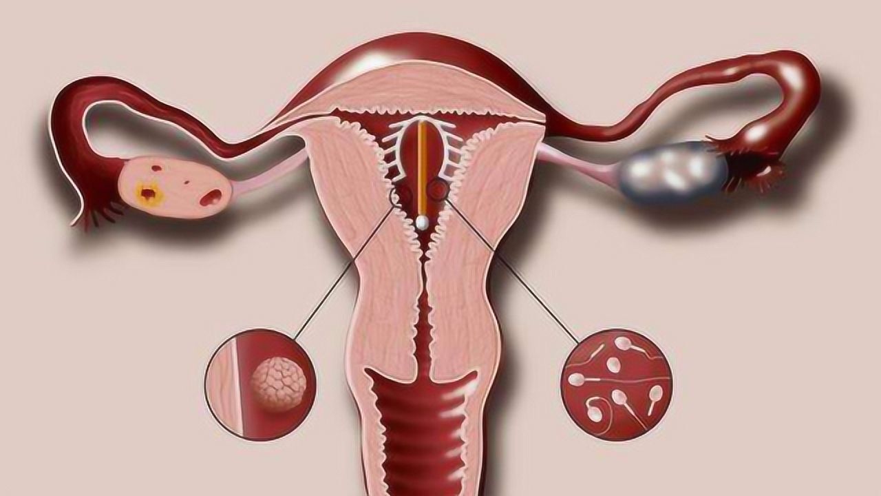 3d大片动画演示:女人"绝育环"手术全过程,你还敢尝试吗?