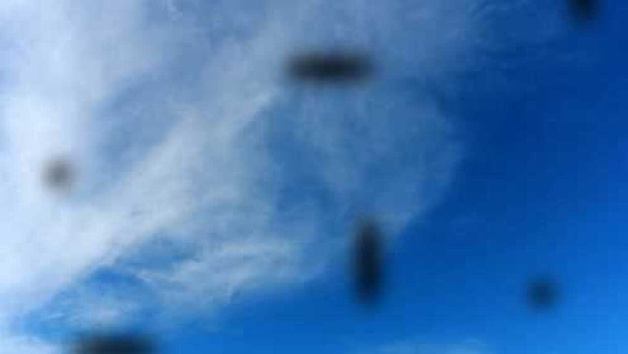 眼前有黑影或者漂浮物是眼睛出了什么问题?眼科医生告诉你真相