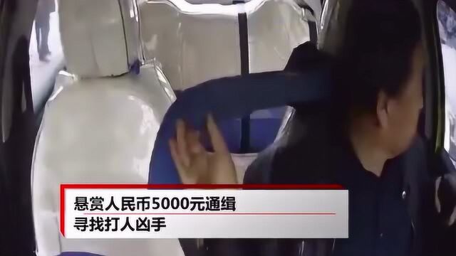 出租司机无故被围殴,出租公司悬赏缉凶:目前当事人已归案