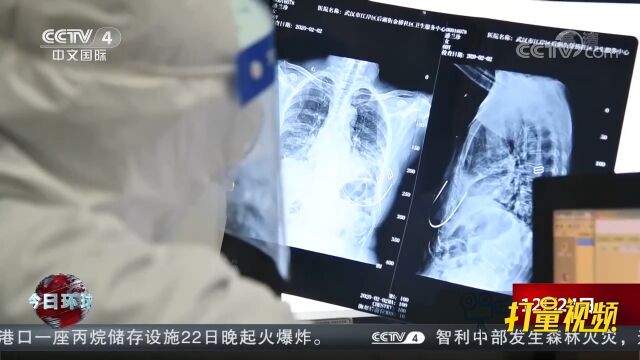 国务院联防联控机制:重点人群如何重点防治