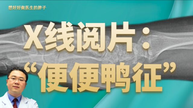 手腕摔伤后,拍一张X线片子是否多余?医生用一例少见病例告诉您