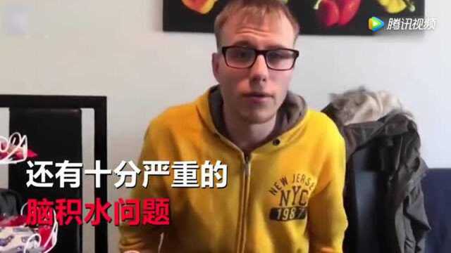 英国惊现恐怖双面女友 人前做善事人后向男友挥刀泼开水!