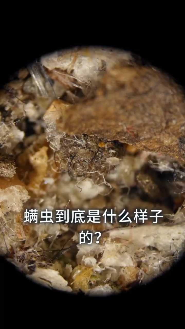 螨虫在显微镜下的样子你见过吗