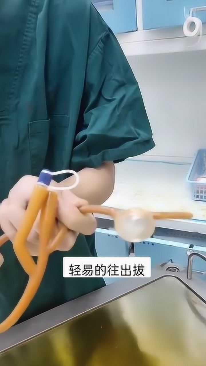 乱拔尿管严重者会出现尿道断裂哦一定好好听医生的话