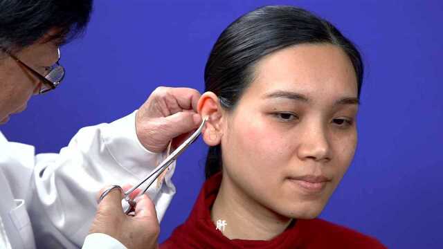 《张仁特色针刺技法》2--耳穴贴压法