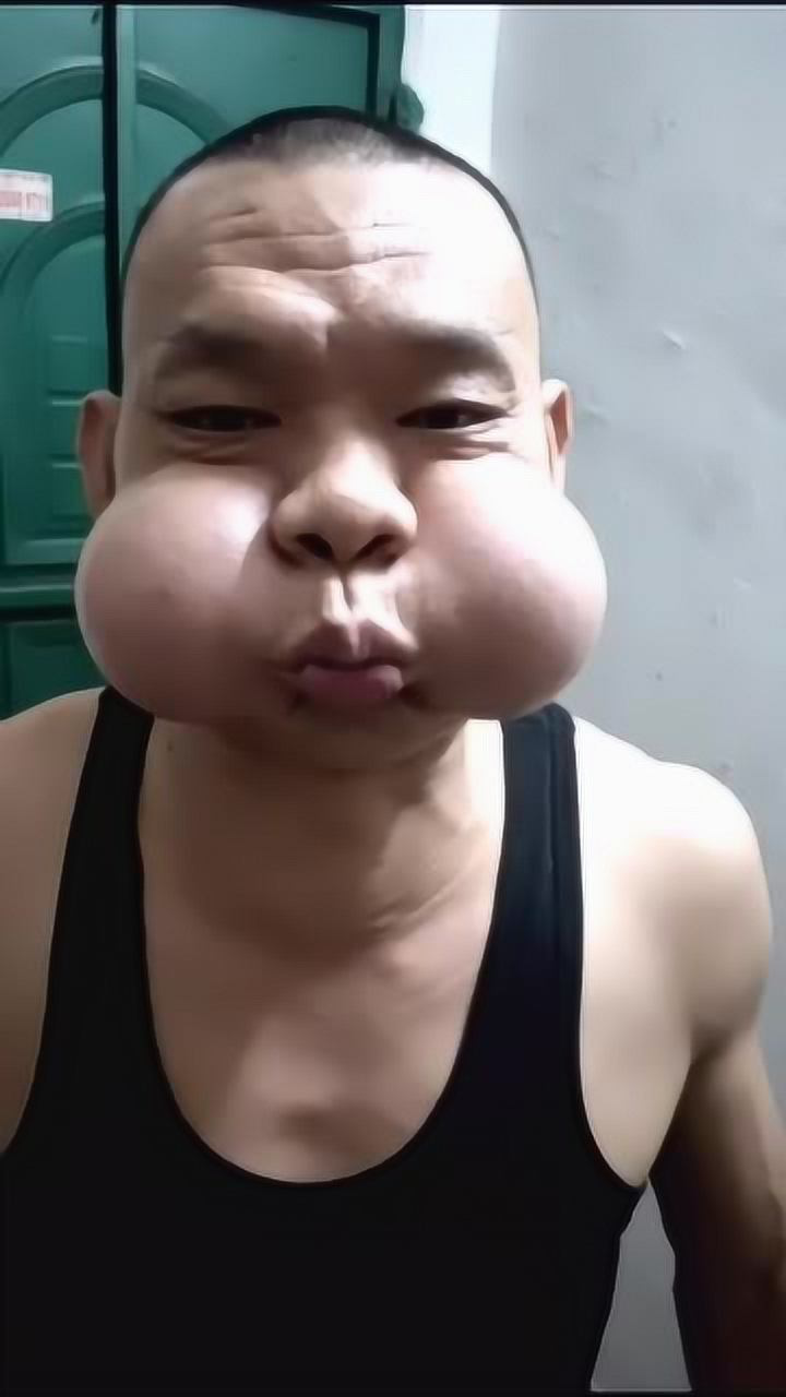 吹唢呐退休工后遗症是大腮帮子朋友看见都惊呆了