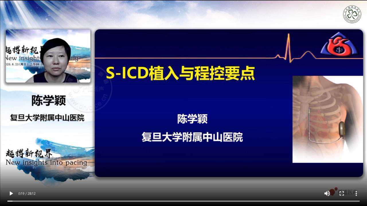 06-陳學穎 sicd植入與程控要點826次播放2020年09月17日軟件下載