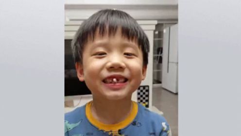 真正的 “笑掉大牙”！6岁男孩解锁掉牙新技能 直接把牙齿给“ci”掉了