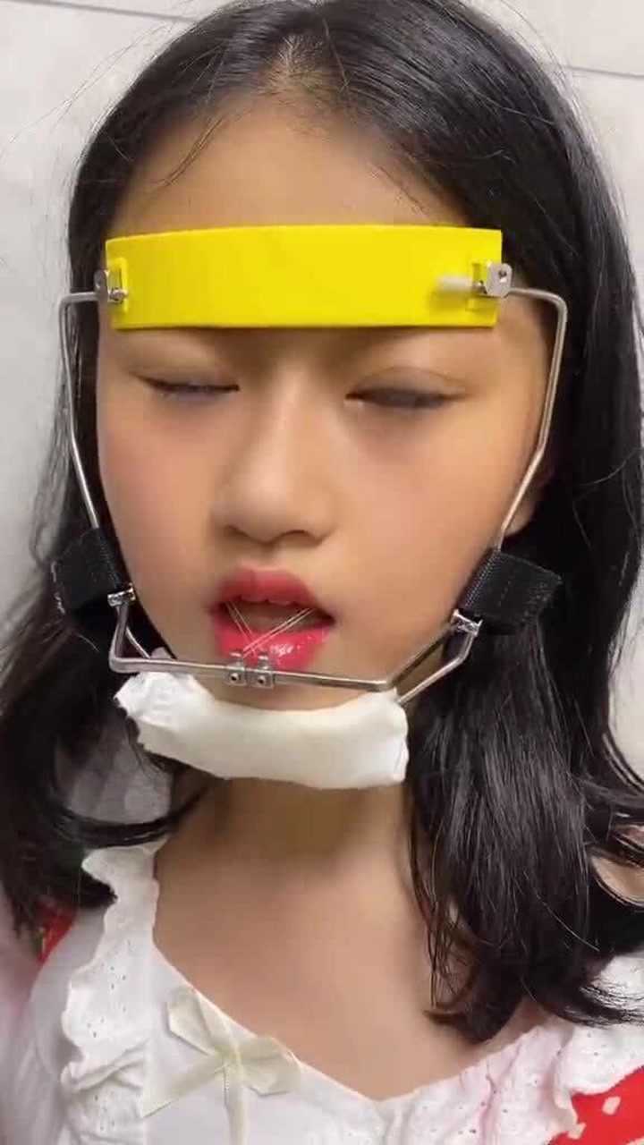 孩子带牙套,太特别了