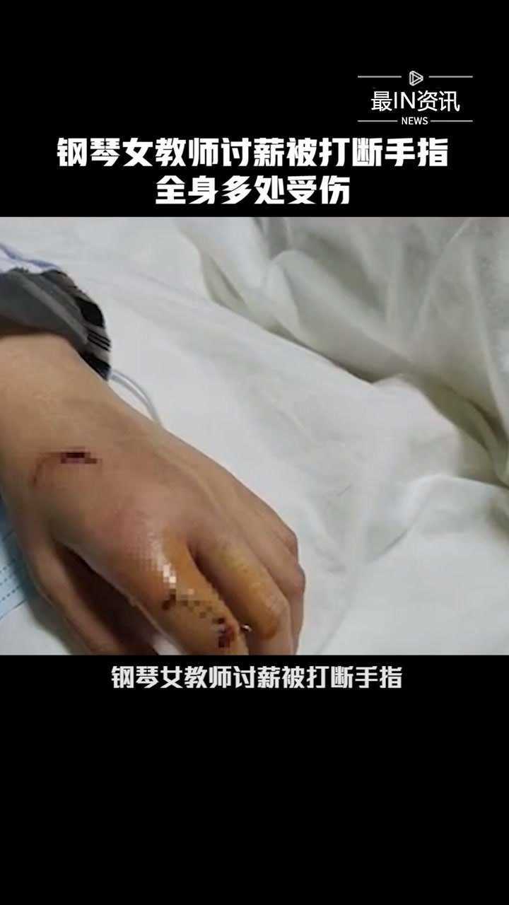 钢琴女教师讨薪被打断手指全身多处受伤钢琴女教师讨薪被打断手指最in