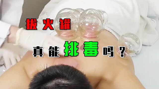 拔火罐真的能排毒吗? #知识ˆ’知识抢先知#