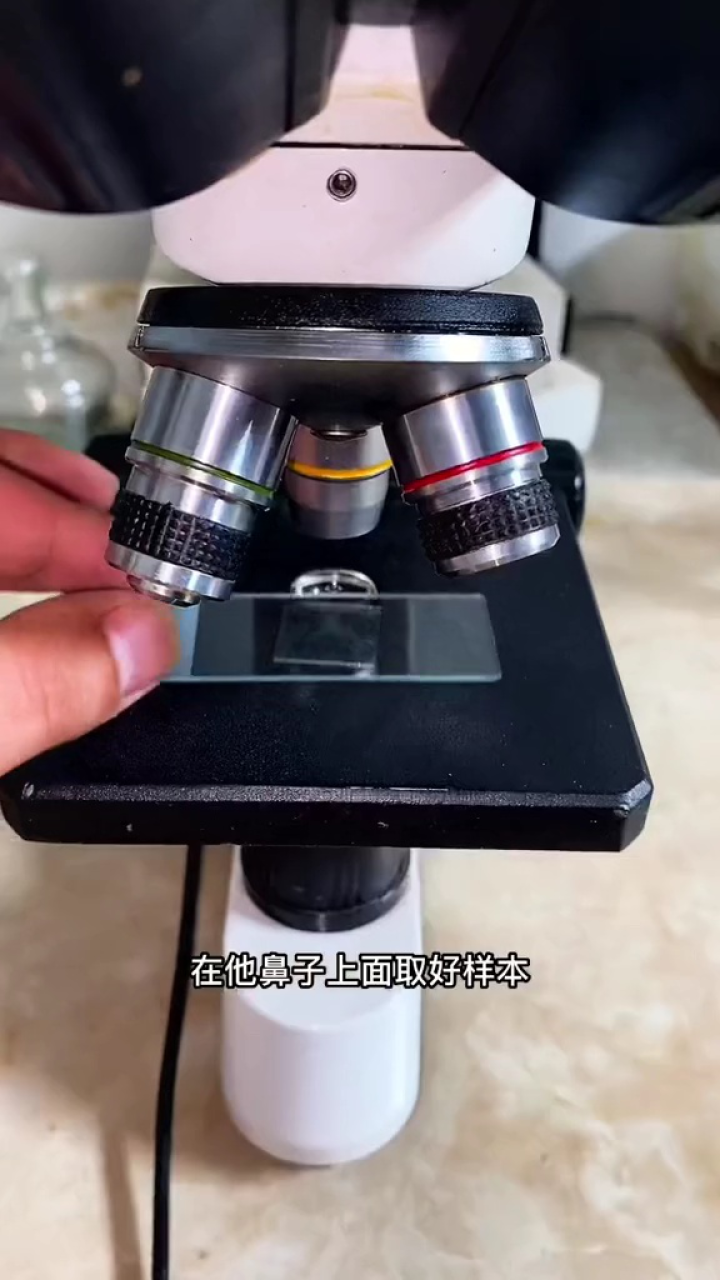 显微镜下的微观世界:黑头放大500倍是什么样子?_腾讯视频