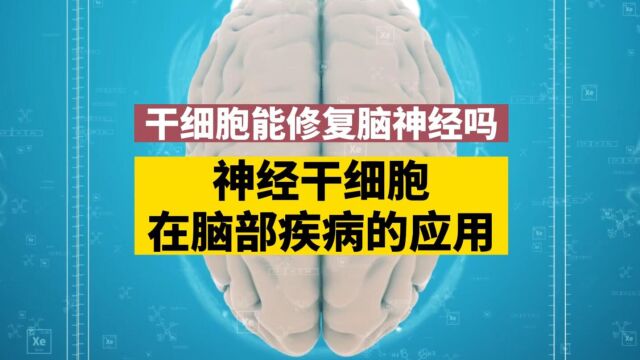 北联世纪:干细胞能修复脑神经吗?神经干细胞在脑部疾病中的应用