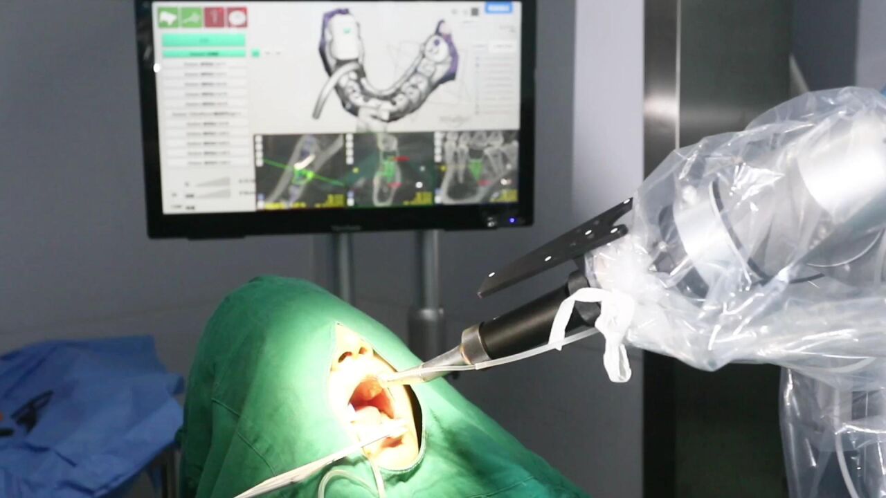 全县首例!滑县人民医院开展机器人口腔种植手术