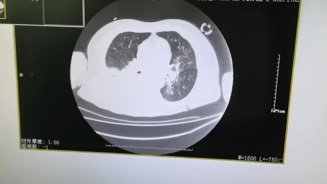 【“医”心守护迎新春】重症医学科:用坚守践行医者誓言