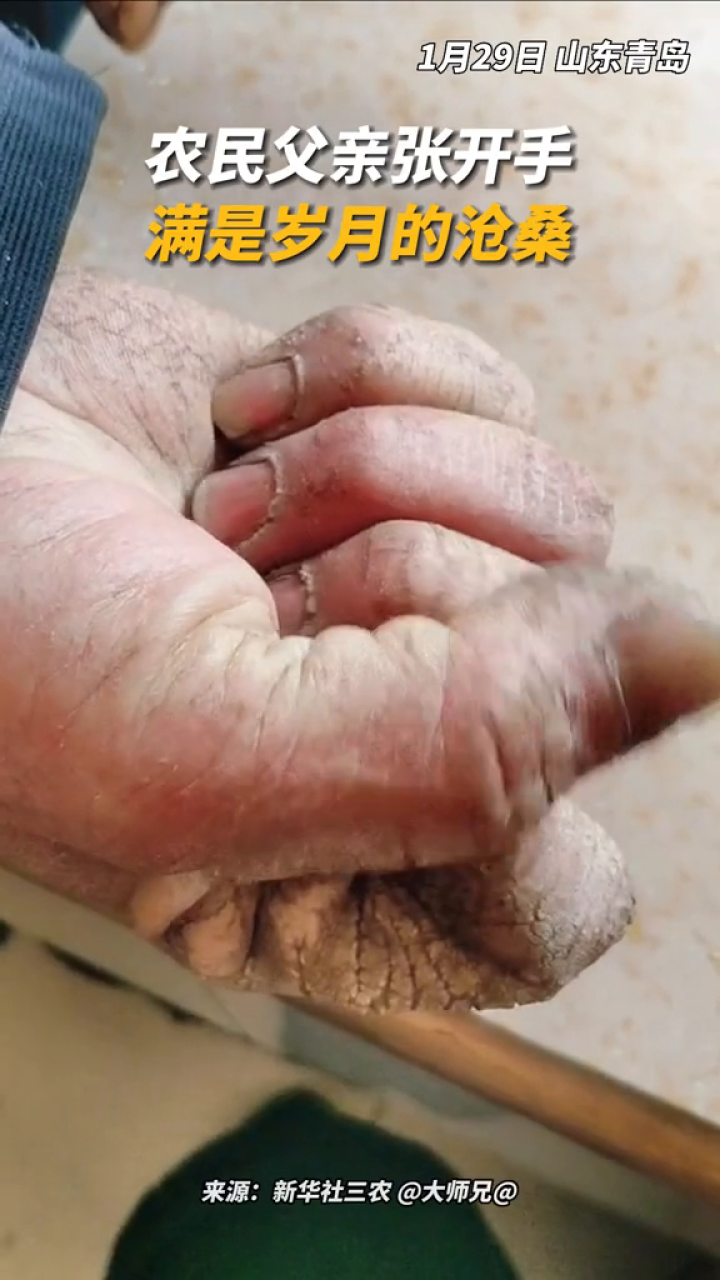 农民父亲张开手,满是岁月的沧桑,网友:是一双撑起生活重担的手