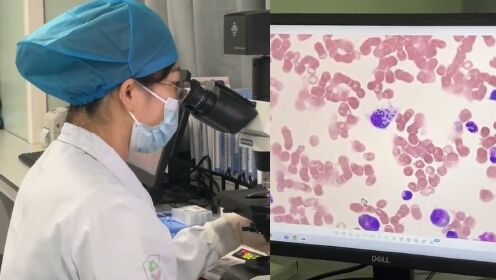 深圳发现一例黑热病患者：高烧不退 该病在我国流行区已基本消灭