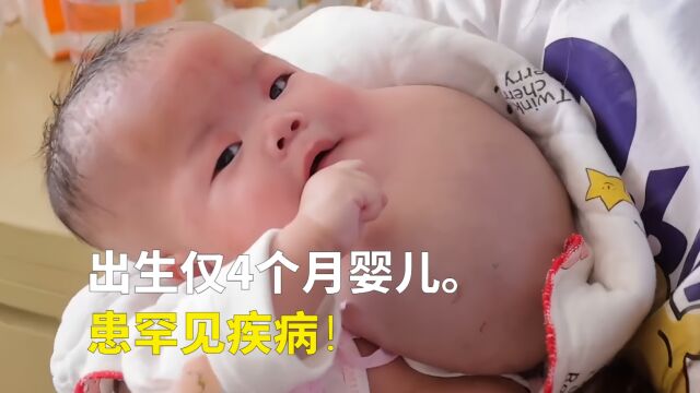 出生仅4个月婴儿.患罕见疾病!