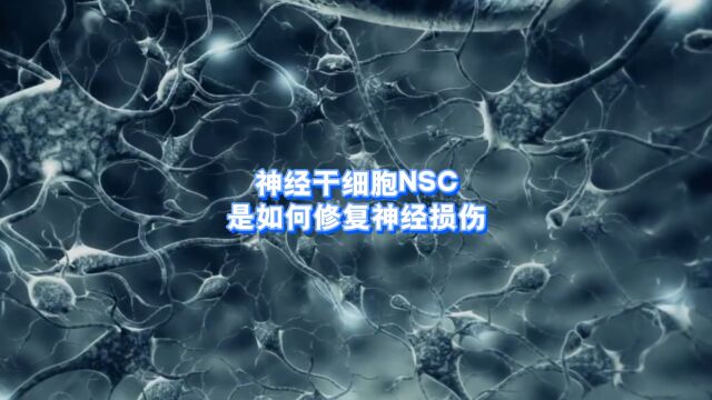 神经干细胞(NSC)是如何修复神经损伤的?神经干细胞哪里可以做?