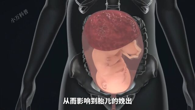 剖腹产是如何进行的?你绝对想不到女性居然需要经历七层切割才能取出胎儿.