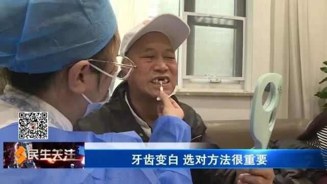 牙齿变白 选对方法很重要