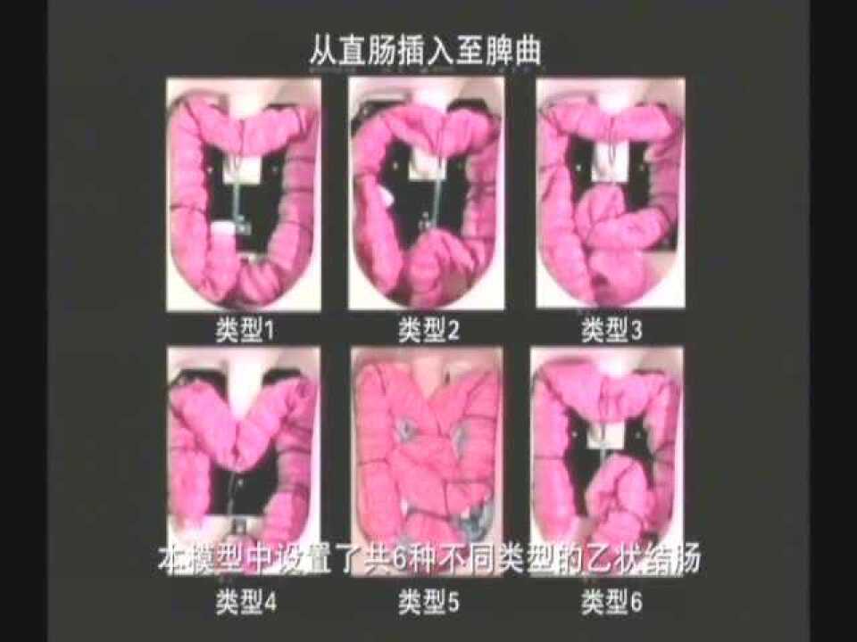 结肠镜插入法指南_高清