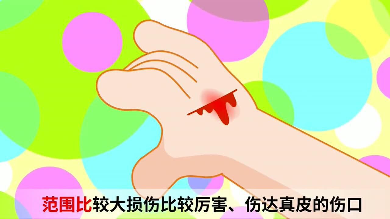 伤口愈合时我们要注意什么_高清1080P在线观看平台_腾讯视频