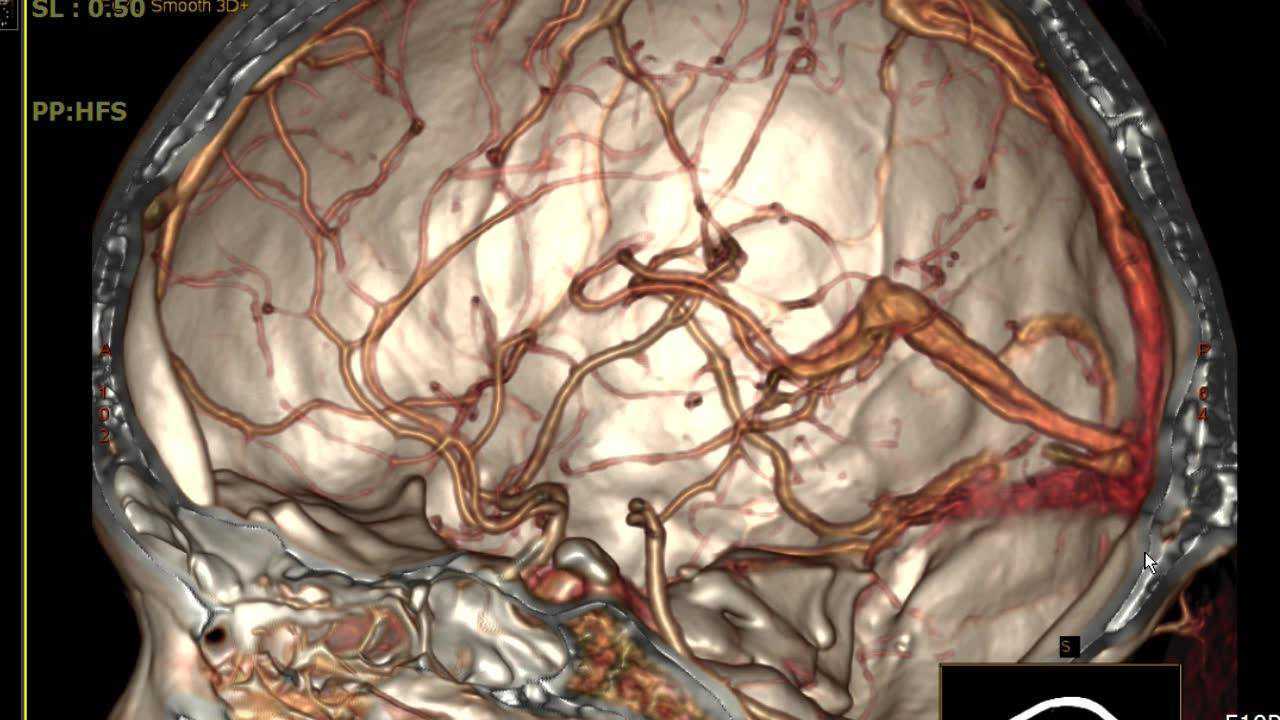 温州医科大学pacs医学影像实验室  颅脑静脉mrv