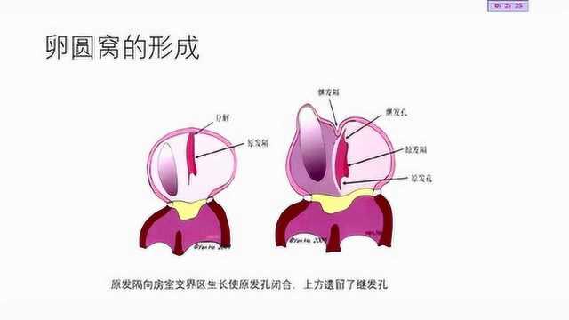 华医心诚专家讲堂:郭炜华“临床电生理与心脏解剖左心房篇”