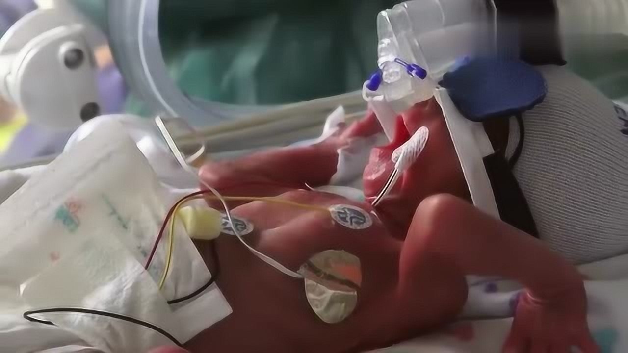 32周早产宝宝脆弱得让人心疼爸爸拍了一段令人难以置信的视频