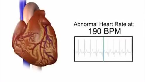 这是一个心脏以不同速度跳动的动画 医学界网站的秒拍视频