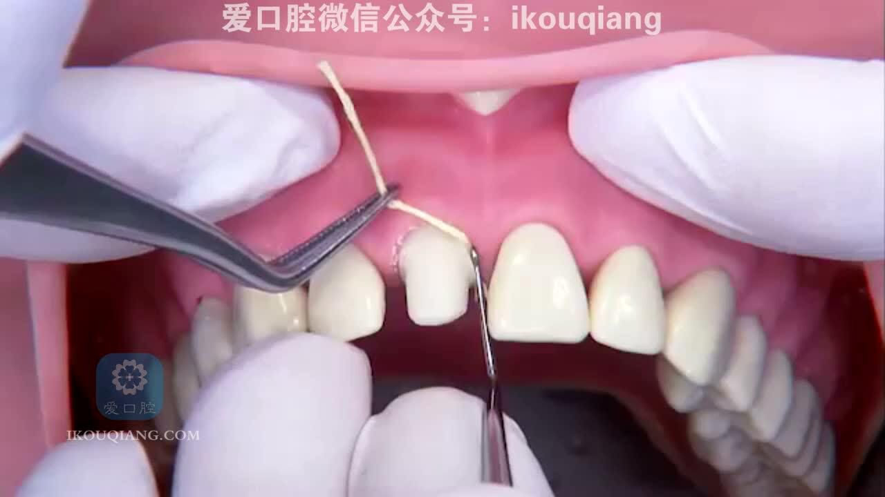 30秒带你看懂排龈_高清1080P在线观看平台_腾讯视频