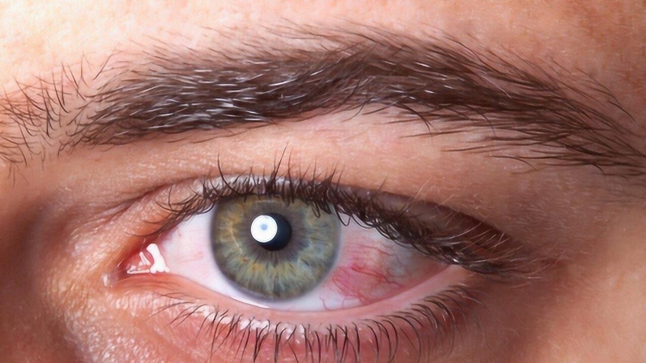 近视眼熬夜玩手机多吃这3种食物有益于眼睛视力健康