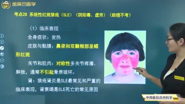 你了解系统性红斑狼疮(SLE)吗?我们应该如何有效的去治疗?