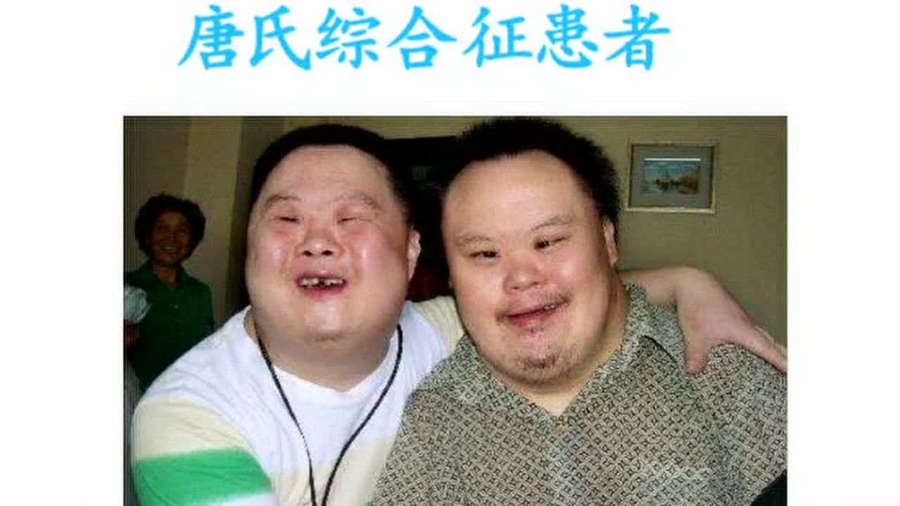 唐氏筛查健康宣传片