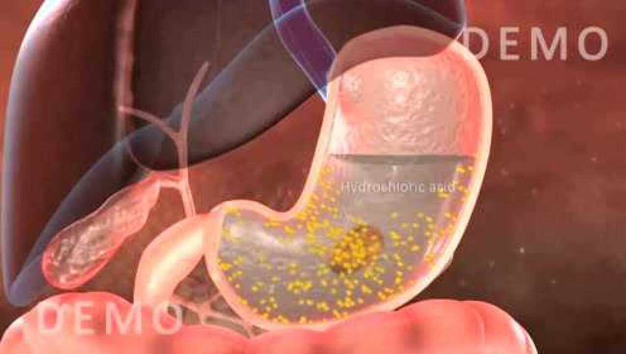 国外动画演示:人体消化系统-食道和胃_腾讯视频
