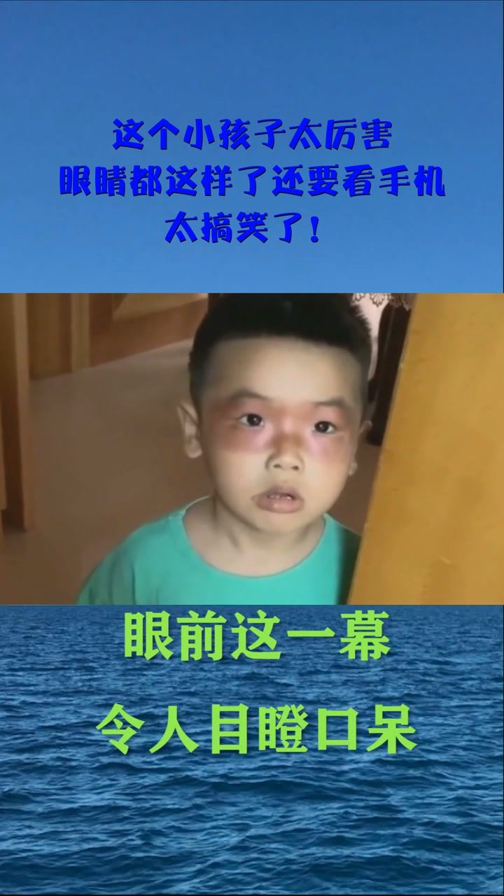 这个小孩子太厉害眼睛都这样了还要看手机太搞笑了